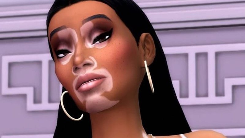 EA introduz vitiligo como nova opção de personalização em The Sims 4 - Foto: Reprodução / EA / YouTube
