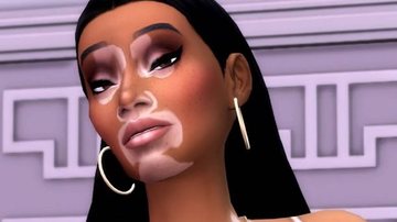 EA introduz vitiligo como nova opção de personalização em The Sims 4 - Foto: Reprodução / EA / YouTube
